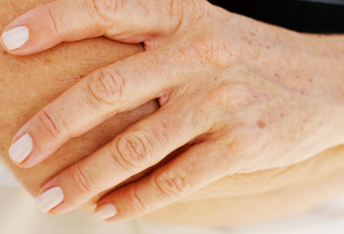 common warts on fingers. lessen their appearance.